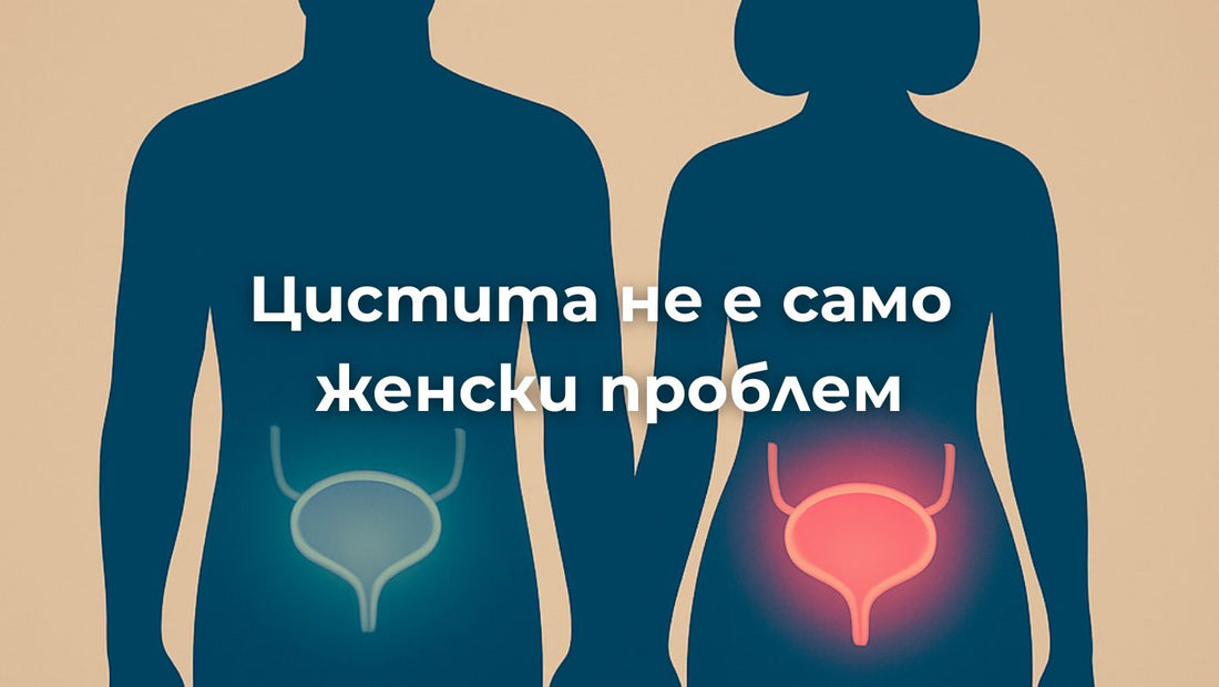 „Мъжете не боледуват от цистит!“ – Mит или истина?